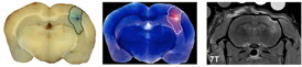 Pathologic and MRI evidence of blood-brain-barrier (BBB) disruption induced
by the VEIN (Vascular Enabled Integrated Nanosecond) pulse generation system. 