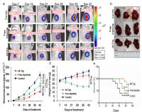 This image proves that Nf-Trip suppresses tumor growth of HCC orthotopic model.

Credit:  Institute for Basic Science