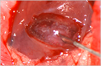 Hemostasis in a rat liver laceration model. Incision was made on the left hepatic lobe. Bleeding decreased immediately following application of the 1.5% (w/v) SPG-178 hydrogel to the bleeding surface. Because SPG-178 hydrogel is transparent, the bleeding surface was visible.