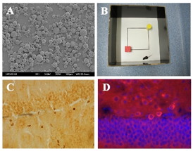 A) Biodegradable polymeric nanoparticles.
B) Test to analyze short-term memory in transgenic mice with Alzheimer.
C) and D) Markers to analyze neurogenesis.