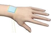 A new kind of stretchy "electronic skin" (blue patch) is the first to be able to detect directional pressure.
Credit: American Chemical Society