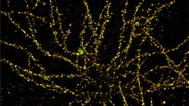 Fluorescent amyloid beta oligomers (green), bound to cultured hippocampal neurons, were detected with greater than 90 percent accuracy by the magnetic nanostructure probe (red).Adapted from Viola et al., Nature Nanotechnology, 2014.