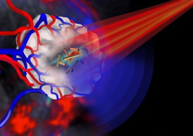 Pulsed near infrared light (shown in red) is shone onto a tumour (shown in white) that is encased in blood vessels. The tumour is imaged by multispectral optoacoustic tomography via the ultrasound emission (shown in blue) from the gold nanotubes.

Image credit: Jing Claussen (Ithera Medical, Germany)