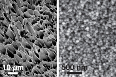 These scanning electron microscopy images, taken at different magnifications, show the structure of new hydrogels made of nanoparticles interacting with long polymer chains.

Courtesy of the researchers