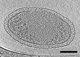 This cryo-electron tomography image reveals the internal structure of an ultra-small bacteria cell like never before. The cell has a very dense interior compartment and a complex cell wall. The darker spots at each end of the cell are most likely ribosomes. The image was obtained from a 3-D reconstruction. The scale bar is 100 nanometers.
CREDIT: Berkeley Lab