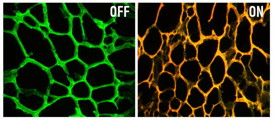 At left is the new nanodevice, consisting of a hydrogel embedded with gold nanoparticles coated with DNA targeting a gene called MRP-1. At right, the device fluoresces after encountering the target gene sequence.

Courtesy of the researchers