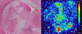 This is an autoradiograph of a brain section of a laboratory mouse after a Stroke (affected areas in white) and the same section with the nanoparticles marked with radioisotopes, which are concentrated in the area of the stroke.
CREDIT: MPIKG