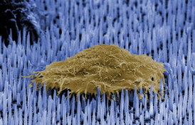 The image shows a single human cell (brown) on a bed of nanoneedles (blue). This image was taken by the researchers using electron microscopy.
CREDIT: Imperial College London