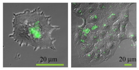 This image shows fluorescent nanoparticles in cells.
CREDIT: Elena Petersen