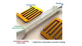 This schematic illustration shows the high-throughput device for separating cancer cells from white blood cells.
CREDIT: Carnegie Mellon/MIT/Penn State