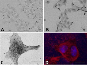 Gold rush
Cancer-seeking peptides  pHLIPs  find acidic tumor cells. By attaching gold nanoparticles to pHLIPs, cancer cells receive antennas for radiation therapy. Cancer cells (A) treated with gold alone (dark areas) take up far less gold than cells with gold delivered by pHLIPs (B). C and D are cellular close-up with pHLIP-delivered gold.
Images: Reshetnyak and Andreev/URI