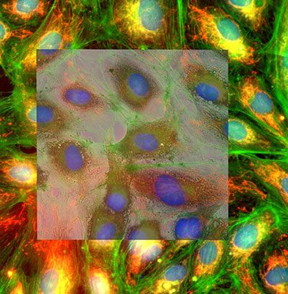 An image showing the highly effective overlay of SEM and fluorescent images of Delphi  Cultured endothelial cells grown on ITO coated coverslip. Staining: DAPI (blue), Phalloidin (green), MitoTracker (red). Sample courtesy M.J. Mourik, LUMC, Leiden.