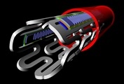 A multi-tasking stent can measure blood flow, take temperature readings, release drugs and dissolve when it's no longer needed. 
Credit: Kim lab image, adapted from ACS version 