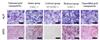 Human mesenchymal stem cells (hMSCs) resulted from the following steps: each type of gold nanoparticles was added to hMSCs, and the treated cells were cultured for 3 weeks. The cells received either alkaline phosphatase (ALP) staining or alizarin red staining (ARS) of calcium phosphate deposits, both of which are osteogenic differentiation indicators. Control experiments with unmodified gold nanoparticles and untreated hMSCs were also carried out for comparison. In the upper images, ALP positive cells were stained purple while agglomerates of gold nanoparticles were detected as blue dots. In the lower images, spider-web-like red stains represent calcium phosphate deposits while bluish purple dots indicate agglomerates of gold nanoparticles. All scale bars are 500 μm.