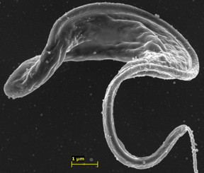 This is the parasite Trypanosoma brucei with targeted nanoparticles adhered to its surface.
CREDIT: Garcia-Salcedo et al, CC-BY