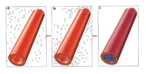 a) This image shows loading clay nanotubes with drug from saturation solution. b,c) Mixing with drug solution, pumping out air, and pulling in drug molecules, washing, and loaded tubes.
CREDIT: the author's of the article