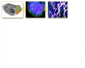 This is an MRI image (left) of a tumor shows nanoparticle accumulation in color. At the cellular level, tumor cells (blue), ferumoxytol (green) and a therapeutic nanomedicine (magenta) can be seen.
CREDIT: Miller M et al., Massachusetts General Hospital and Brigham and Women's Hospital