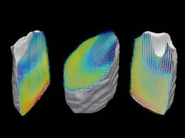 Representation of the orientation of collagen fibers within a tooth sample. The samples three-dimensional nanostructure was computed from a large number of separate images recorded by X-ray scattering CT. Image: Schaff et al. / Nature