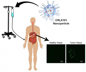 The nanoparticle therapeutic CRLX101 (schematic illustration provided by Cerulean Pharma Inc.) was given intravenously to patients with stomach cancer. Biopsies were taken of both the stomach tumor and nearby, healthy tissue. Evidence of the nanoparticle delivered drug (bright green dots) was seen only in the tumors of the nine patients investigated, and not in their adjacent healthy tissue.
Credit: Courtesy of the M. E. Davis Laboratory/Caltech