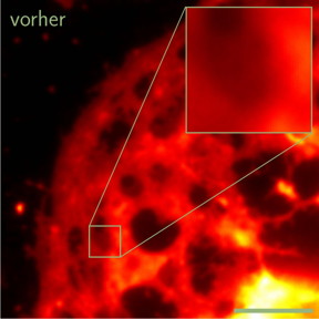 The images show a liver cell before and after processing the data with the software developed at Bielefeld University.

Photo: Bielefeld University