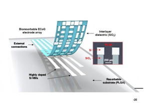 Thin, flexible neural electrode arrays with fully bioresorbable construction based on patterned silicon nanomembranes (Si NMs) as the conducting component.
CREDIT: The lab of Brian Litt, MD, Perelman School of Medicine, University of Pennsylvania