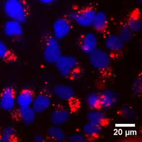 Image shows HeLa cells incubated for 24 hours with serum-coated TiO2 nanoparticles (proteins are tagged with a red fluorophore). Cell nuclei are stained with DAPI (blue).

Credit: Georgia Tech