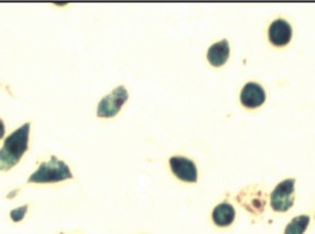 Mesenchymal stem cells have labeled with Ferumoxytol using a bio-mimicry method developed at Carnegie Mellon University. The method can be used to better evaluate stem cell therapies in preclinical and clinical trials.
CREDIT: Carnegie Mellon University