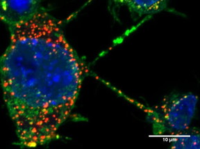 Neuronal cells connected by TNTs which containing synuclein fibrils (aggregates in red) inside.

 Institut Pasteur