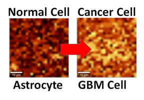 Normal and cancerous brain cells interfaced with graphene show different activity levels under Raman imaging.
CREDIT
UIC/Vikas Berry