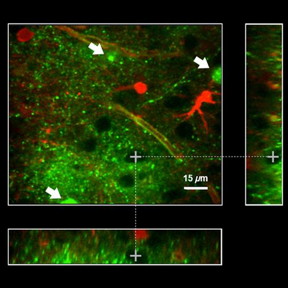 A new optical nanosensor enables more accurate brain mapping and opens the way for broader applications in future; Fig. 5 in a paper reporting on the work shows retention of a potassium nanosensor in the extracellular space. doi:10.1117/1.NPh.4.1.015002
CREDIT
The authors