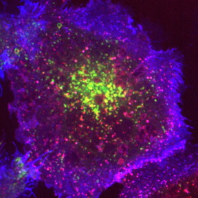 Photocaption: endocytic vesicles made by hot-wiring
Credit: Gabrielle Larocque
Image taken in Stephen Royles lab (The pinky-purple spots are the endocytic vesicles made by hot-wiring process)