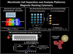 University of Toronto researchers developed a liquid biopsy technology to improve prostate cancer treatment.
CREDIT
University of Toronto