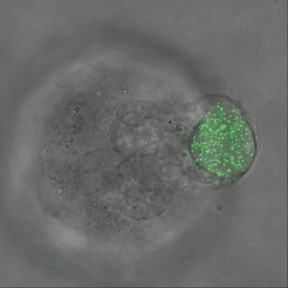 Twenty-four hour time-elapsed video shows melanoma tumor cells of mice squeezing and rotating an elastic microgel sphere filled with fluorescent nanoparticles.
CREDIT
Video courtesy Ning Wang.