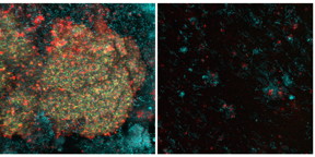 Treatment with a nanoparticle and hydrogen peroxide (right panel) left little in the way of bacteria (in blue) or the sticky biofilm matrix (in red), making the combination a potent force against dental plaque.