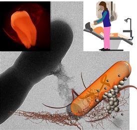 In this illustration, nanoparticles attach to or are taken up by the bacteria cells. Pan and his students are the first group to demonstrate that early detection of dental plaque in the clinic is possible using the regular intraoral X-ray machine which can seek out harmful bacteria populations.

CREDIT
University of Illinois Laboratory for Materials in Medicine.
In this illustration, nanoparticles attach to or are taken up by the bacteria cells. Pan and his students are the first group to demonstrate that early detection of dental plaque in the clinic is possible using the regular intraoral X-ray machine which can seek out harmful bacteria populations.

CREDIT
University of Illinois Laboratory for Materials in Medicine.

