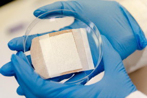 When spun in an electric field -- imagine a cotton candy machine -- the self-aligning cells follow the strand-and-pocket pattern of the underlying nanofibers. Rao's team, including lead author and PhD student Samerender Nagam Hanumantharao and masters student Carolynn Que, found that varying electric field strengths result in different pocket sizes. At 18 kilovolts, the magic happens and the fibers align just so. At 19 kilovolts, small pockets form, ideal for cardiac myoblasts. At 20 kilovolts, honeycombs of pockets expand in the fibers. Bone cells prefer the pockets formed at 21 kilovolts; dermal cells aren't picky, but especially like the spacious rooms that grow at 22 kilovolts.

CREDIT
Peter Zhu/Michigan Tech