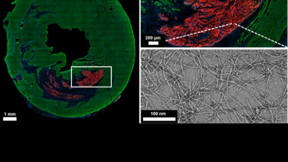 Peptides respond to biochemical signals inside heart tissue (green) following a heart attack, spontaneously forming a gel-like material (red) that could be used for healing. The hydrogel, which can stick to tissue, is made up of nanoscale fibers that tangle together (bottom right).