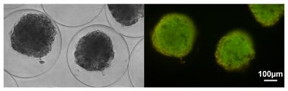 Image of some microencapsulated islets.

CREDIT
Albert Espona-Noguera. UPV/EHU