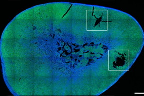 MIT engineers have developed magnetic nanoparticles (shown in white squares) that can stimulate the adrenal gland to produce stress hormones such as adrenaline and cortisol.

Image: Courtesy of the researchers
