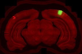 A slice of a rat's brain showing visual cortex neurons (green) and axons from the secondary motor cortex (red).

CREDIT
Courtesy of Grigori Guitchounts