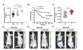 The level of circZFR is associated with CRC stage and survival, and circZFR promotes CRC growth and metastasis in vivo

CREDIT
Science China Press