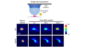 Delayed repair of nuclear envelope rupture in HGPS cells

Credit
 Kono, et al., 2024. Published by Oxford University Press on behalf of National Academy of Sciences.