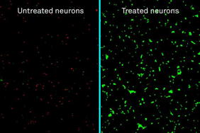 Labeled micrographs of human neurons exposed to amyloid-beta proteins and either left untreated (left) or treated with the new nanotherapy developed at Northwestern (right). Dead neurons are stained in red; live neurons are green.

Credit
Samuel Stupp Laboratory/Northwestern University